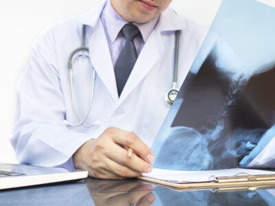 Doctor examine x-ray film over white background Doctor examine x-ray film over white background