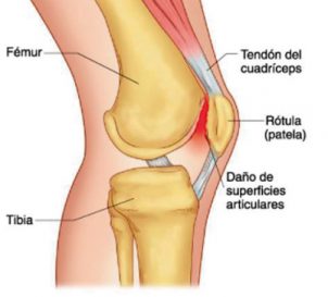 rodilla-302x273 rodilla-302x273